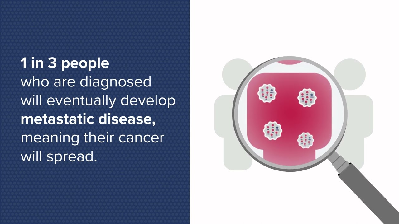 Helping to Address Unmet Needs in Metastatic HR+/HER2- Breast Cancer