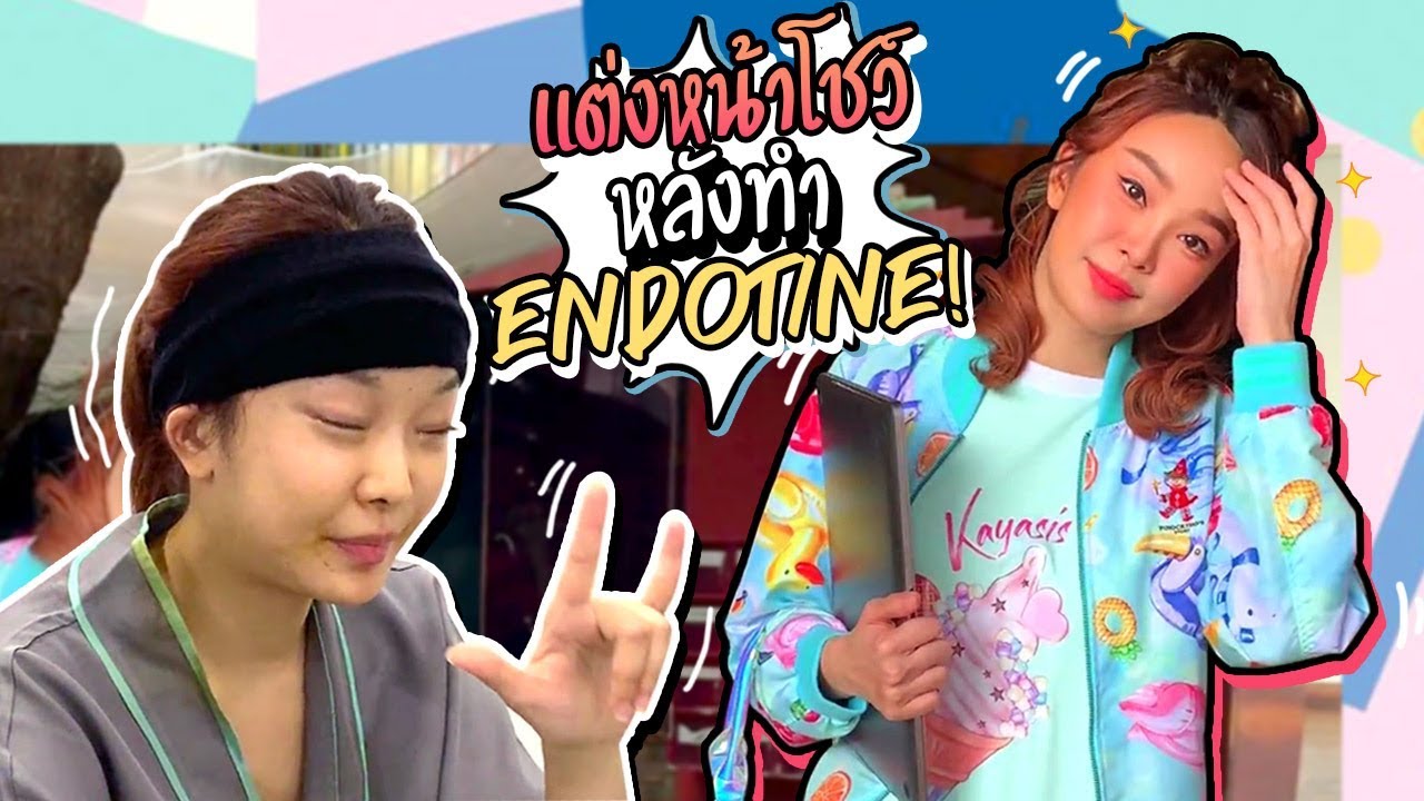 อัพเดตแต่งหน้าหลังศัลยกรรมยกคิ้ว Endotine 9 วัน