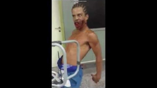 ZOMBIE IS REAL . PATIENT POSSESSED BY SATAN IN MIGUEL COUTO HOSPITAL IN RIO