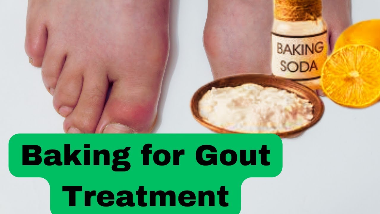 How to use Baking Soda to Cure Gout ll Baking Soda benefits in curing