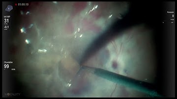 Blutein 500 dye  Ngenuity digital ILM enhancement Lukan Mishev