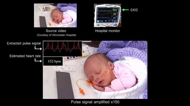 Heartrate Extraction