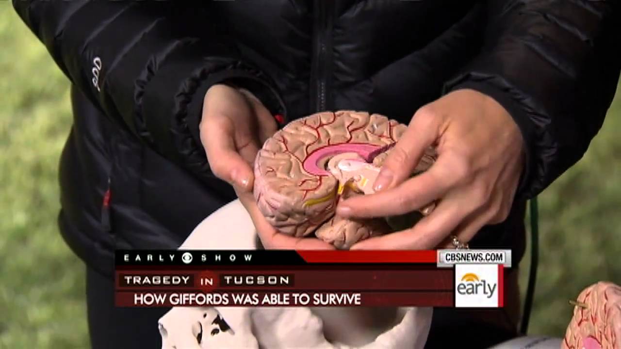 How Rep. Gabrielle Giffords Survived