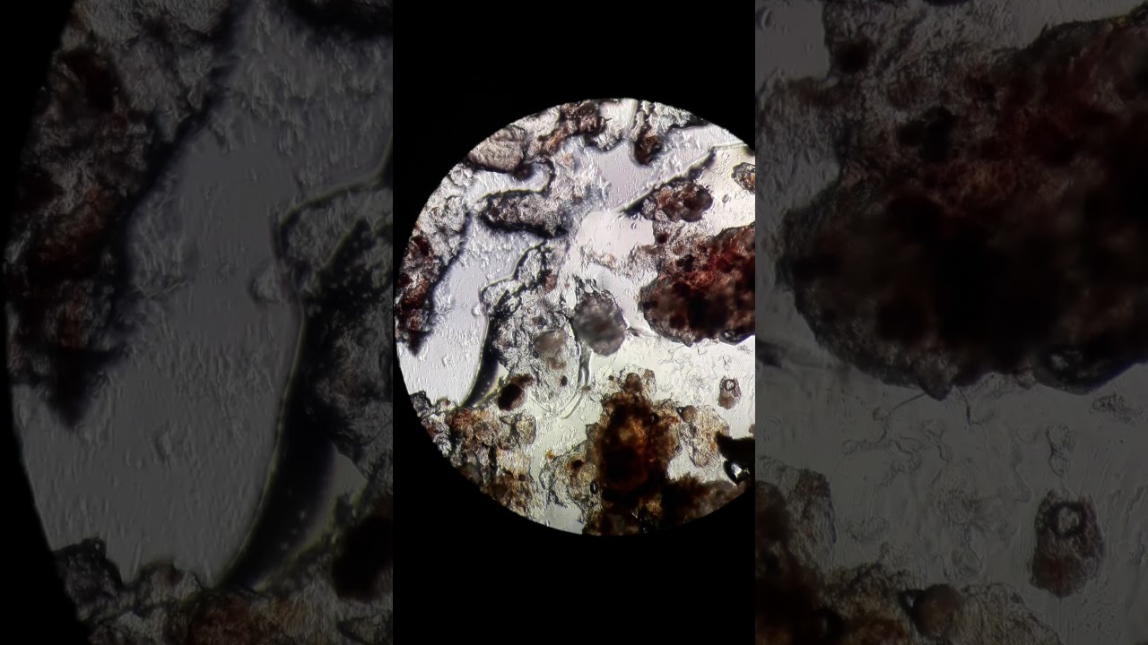 ушной клещ у кота под микроскопом - YouTube