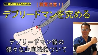 デブリードマンを究める！　〜デブリードマン後の様々な止血法について〜