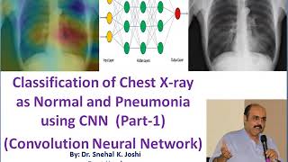 X-ray Image Classification using CNN-01