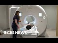 AI-powered MRI scans and a push for hospital price transparency | Eye on America
