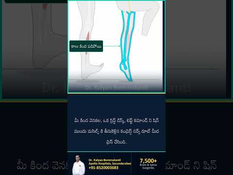 Foot Drop: Nerve Problem, Muscle Kaadu — Best Endoscopic Spine Surgeon, Hyderabad