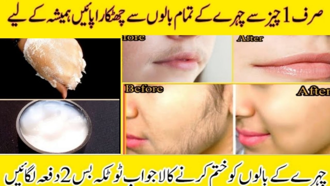 Flawless FACIAL HAIR REMOVAL HOME REMEDY Unwanted Facial hair How