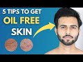 5 Tips to get Oil + Acne Free Skin | Oily Skin Care Tips | Winter Skin Care |