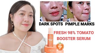 PAANO MAWALA ANG PIMPLE MARKS AND DARK SPOTS | Fresh Skinlab 98% Tomato Booster Serum Review