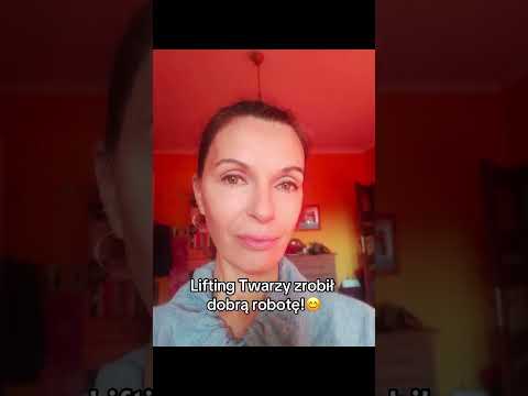 Metamorfoza po Liftingu