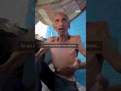 Testemunha viva da fome em Gaza: Salim perdeu mais da metade do peso