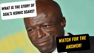 What is the Story Behind Seal’s Scars?