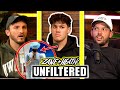 Noah Beck Opens Up About His Surgery - UNFILTERED #77