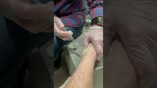 Fixing my ankle