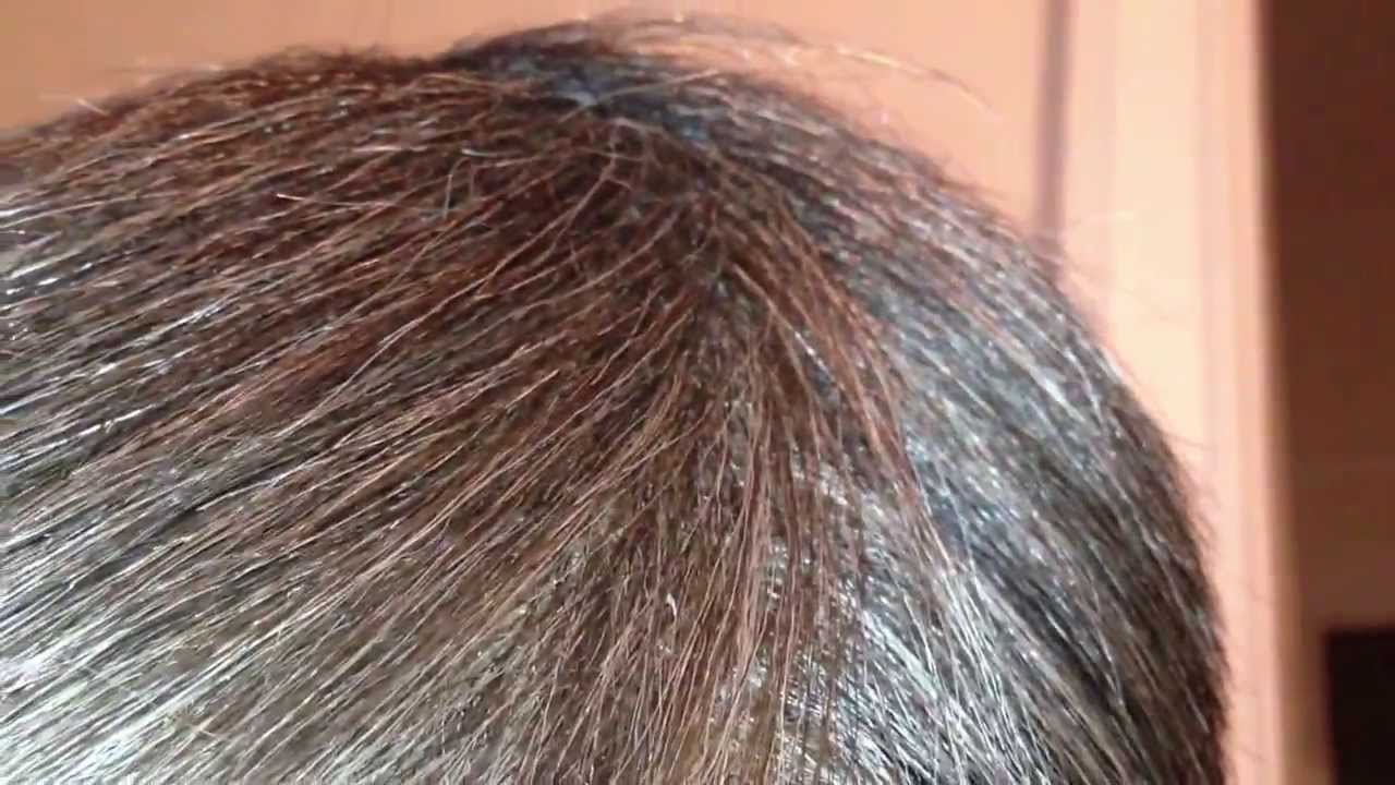 Blonde Hair Turning White: Is It Normal? - wide 4
