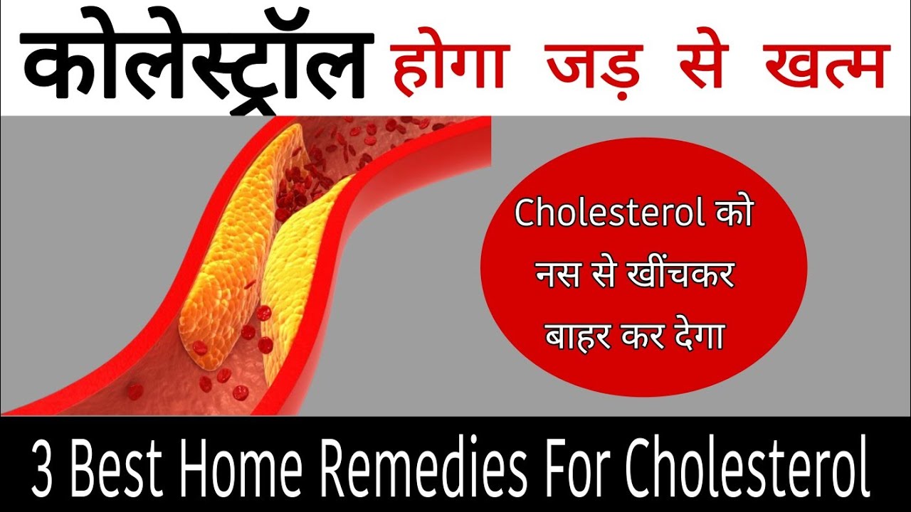 Cholesterol kaise kam kareCholesterol herbal medicineCholesterol