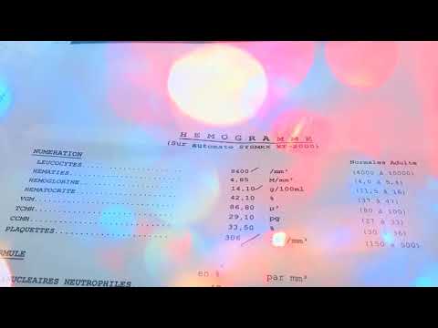 كيف تقرا تحاليل NFS بالتفصيل و بالدراجة الجزء 1 Comment Lire Les Analyses De La NFS Complète 