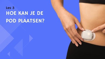 Omnipod DASH Academy | Les 3 - Hoe kan je de pod plaatsen | Diabetotech