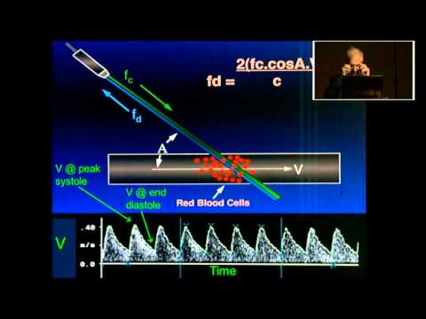 DOPPLER Y RESTRICCIÓN DE CRECIMIENTO INTRAUTERINO DR