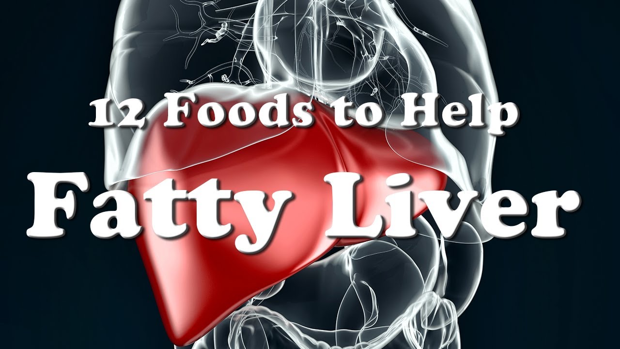12 Foods to Help Fatty Liver Reversal YouTube