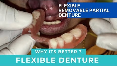 Flexible Partial Denture, details and demo on patient.