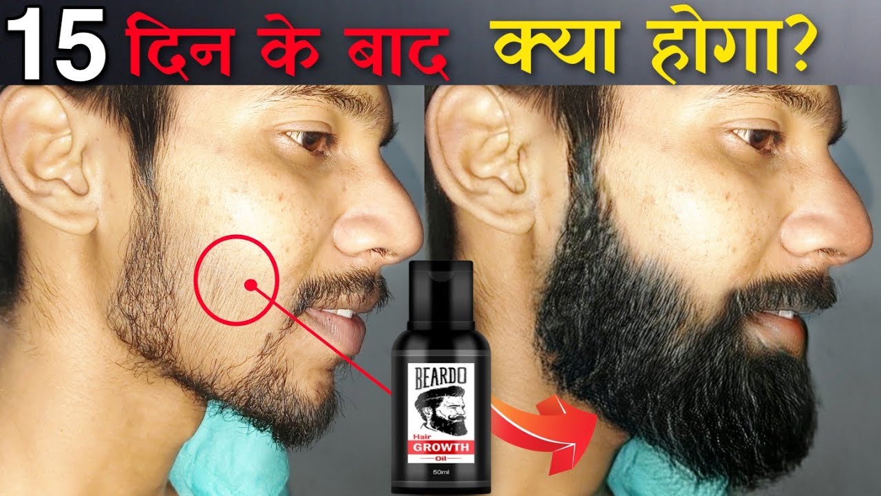 Beardo Hair Growth Oil After 15 Days Review Best Beard Oil For Patchy