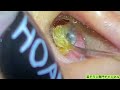 ASMR：1回引き抜くたびに、快感レベルUP！