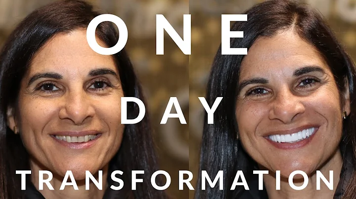 Cosmetic Dental Veneers Review - One Day Smile Makeover from Florida