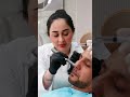 تصحيح البشرة بالديرمابن Dermapen