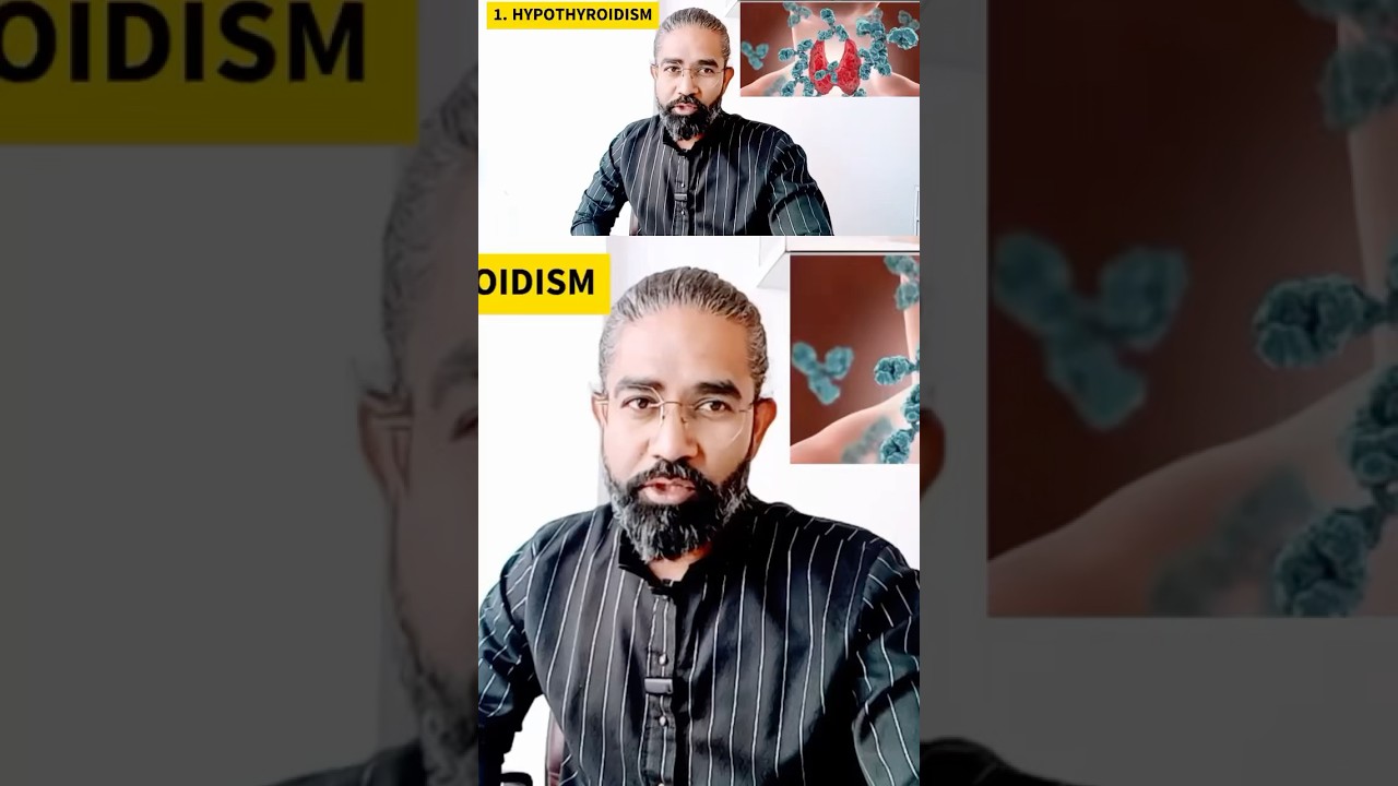 sign of having low thyroid levels! 