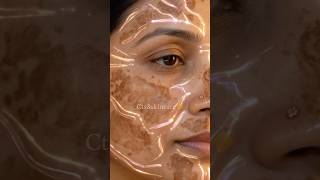 Pigmentation solutions &amp; cause 🙏 #pigmentation #skincaretipsinhindi #beautytips #ashortaday