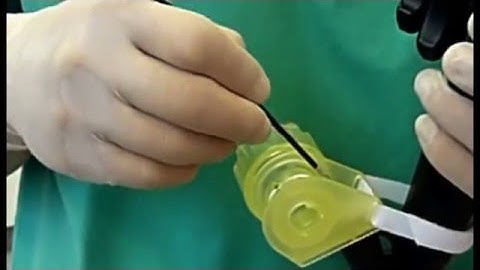 OVESCO OTSC  Anchor for Fibrotic tissue acquisition