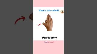 English Vocabulary with Pictures | Learn Words Like Vitiligo, Adam's Apple & More! #quiz #english