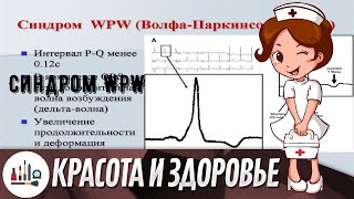 Синдром WPW