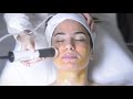 OXYGENEO Waiting room video with Tripollar RF