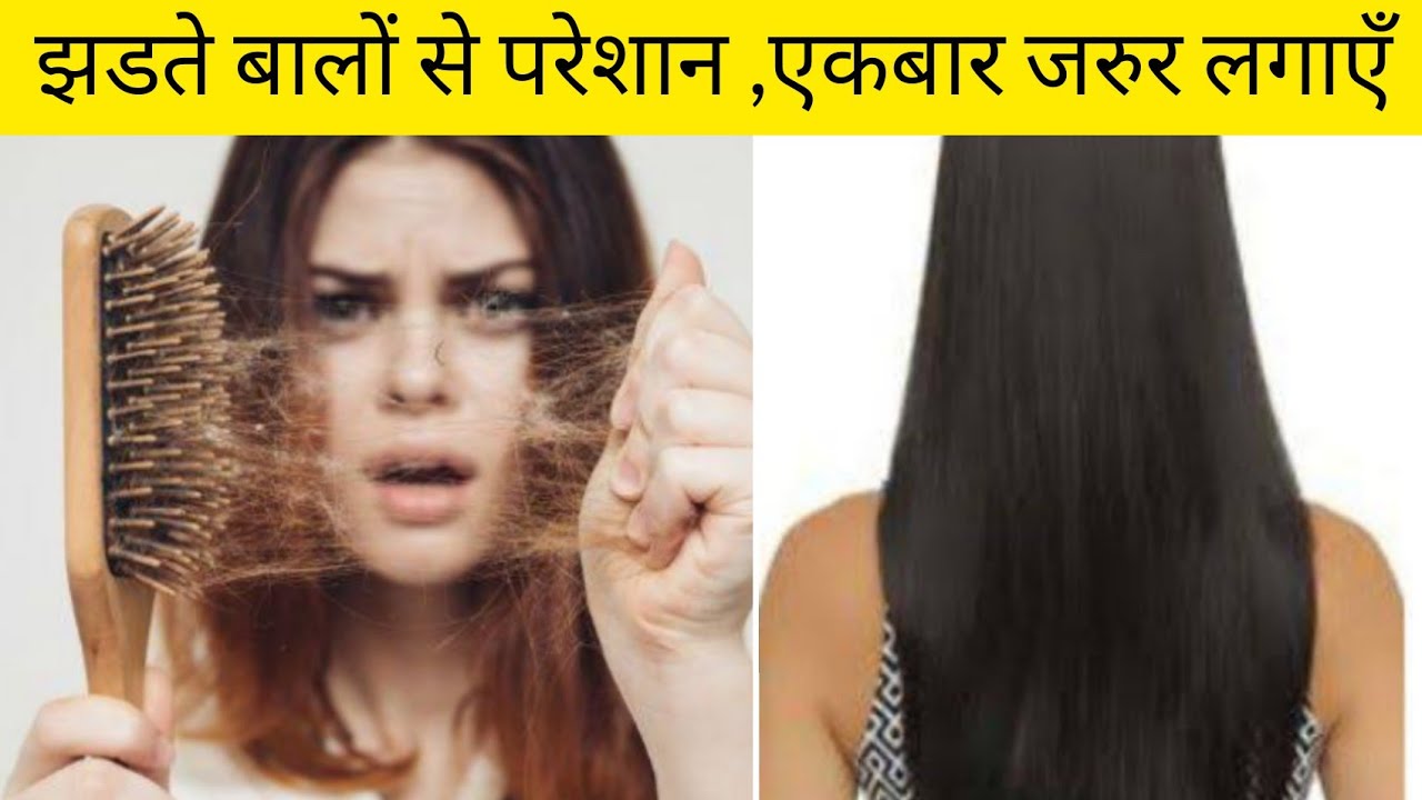 How to Stop Hair Fall Naturally / Grow Hair Faster / Hair fall remedy