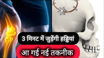 World’s First Bone Glue: Heals Broken Bones in Just 3 Minutes | Inspired by Nature 