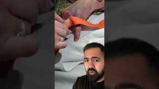Doctor Reacts To Stuck Wedding Ring