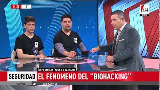 Microchips Implantables En A24 Animaco