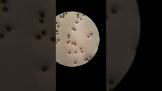 Elater Of Equisetum Spores