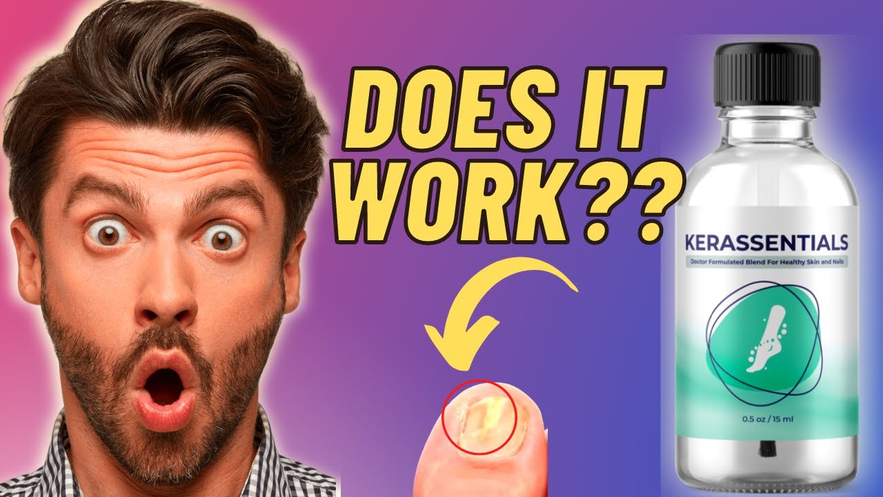 KERASSENTIALS OIL REVIEW (WHY DOES NOBODY SAY THAT?) The Truth !!