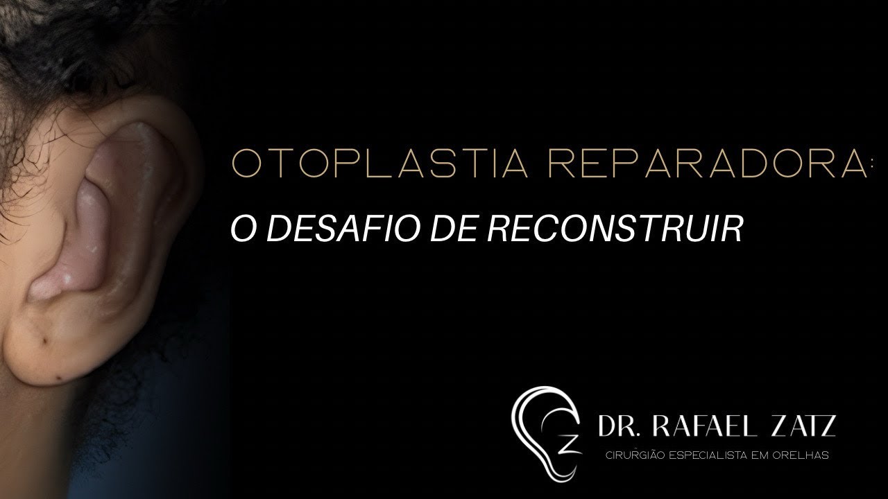 Caso desafiador de uma jovem paciente. #otoplastia