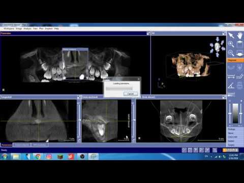 Dental Imaging Software For Mac