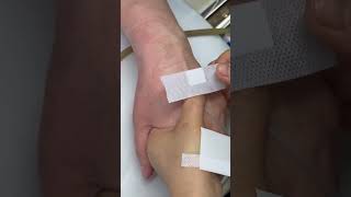 Intramuscular Injection Technique Explained | Safe IM Injection Step-by-Step | Nurse Guide Class 32