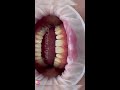 Dentist dentistry    odontologia dental bleach braces veneers