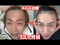 【ハゲ日記】AGA薄毛治療73ヶ月目！