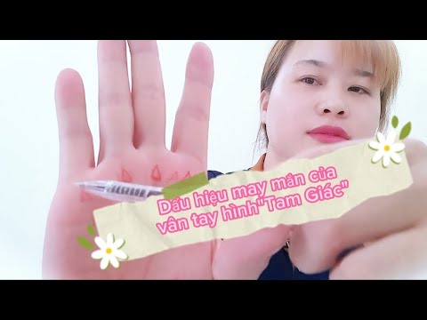 Dấu hiệu may