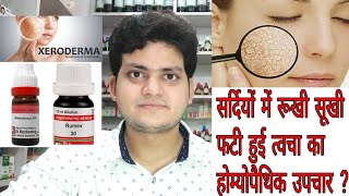 Dry and cracked skin & inching in winter ! Homeopathic medicine !रूखी-सूखी फटी हुई त्वचा ?